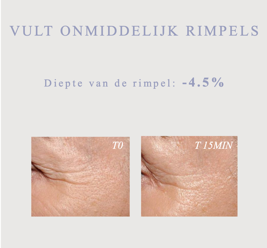 Glow serum voor vollere huid en vermindering van rimpels